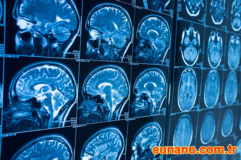 geleneksel tıpın manyetite ile birleşimi geleneksel tıp